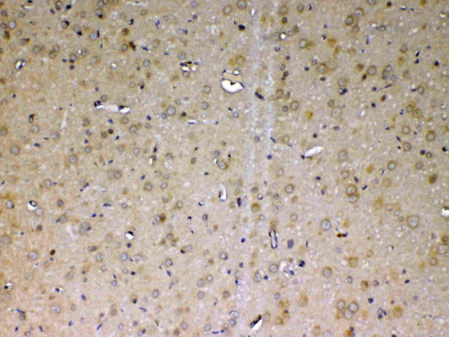 Adenosine Deaminase Antibody in Immunohistochemistry (Paraffin) (IHC (P))