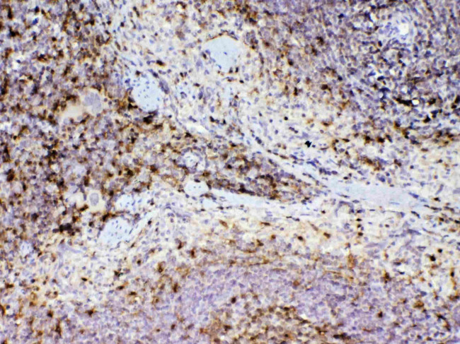 Adenosine Deaminase Antibody in Immunohistochemistry (Paraffin) (IHC (P))