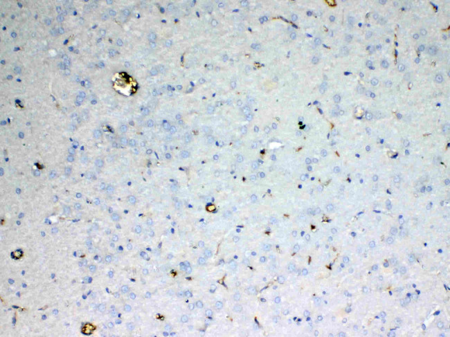 Adenosine Deaminase Antibody in Immunohistochemistry (Paraffin) (IHC (P))