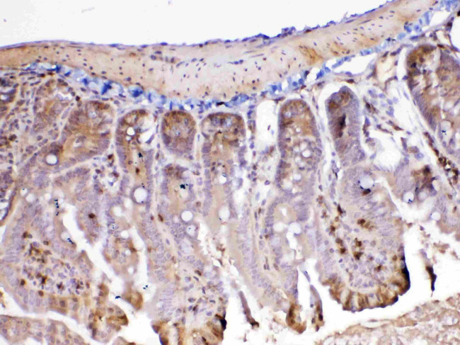 Adenosine Deaminase Antibody in Immunohistochemistry (Paraffin) (IHC (P))