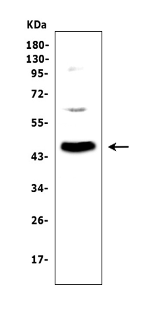 Adenosine Deaminase Antibody in Western Blot (WB)