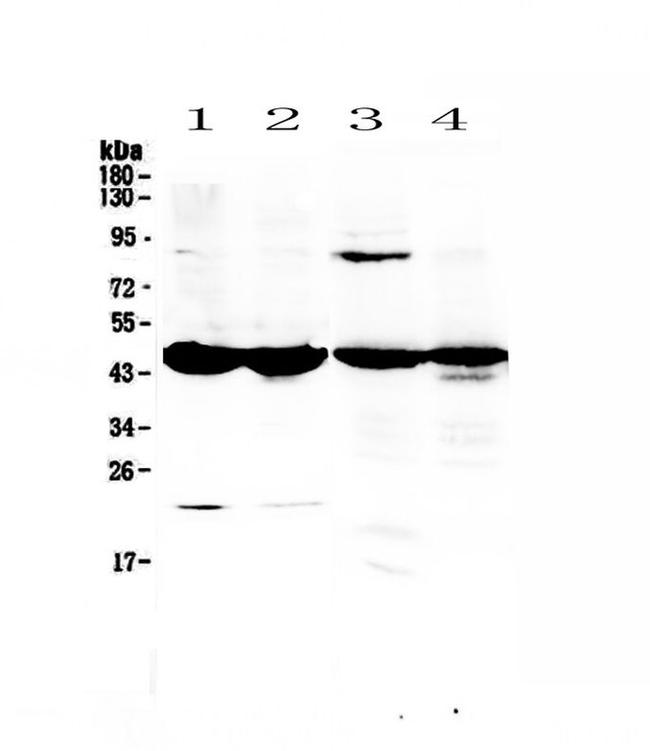 Adenosine Deaminase Antibody in Western Blot (WB)