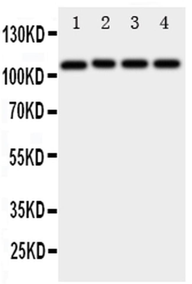 ADAM19 Antibody in Western Blot (WB)