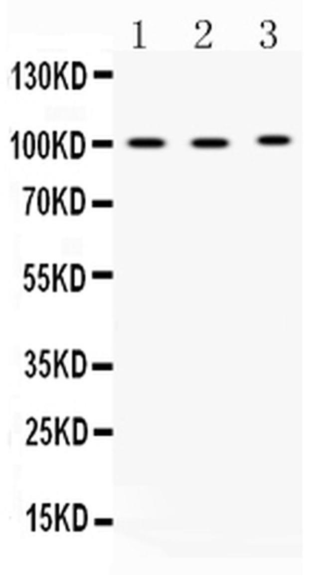 ADAM2 Antibody in Western Blot (WB)