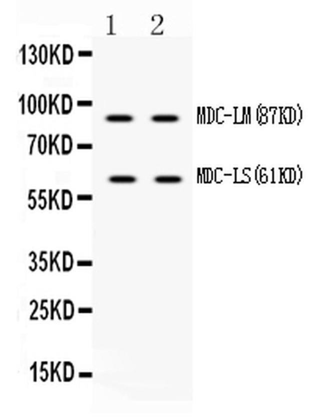 ADAM28 Antibody in Western Blot (WB)