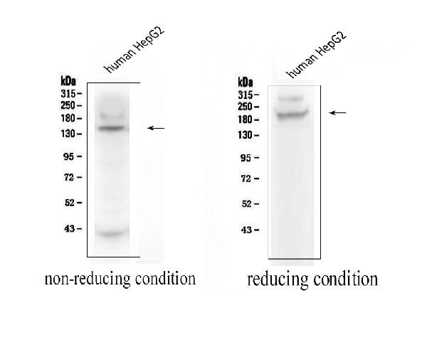 ADAMTS13 Antibody in Western Blot (WB)