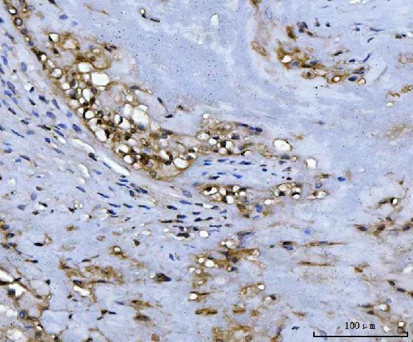 ADK Antibody in Immunohistochemistry (Paraffin) (IHC (P))