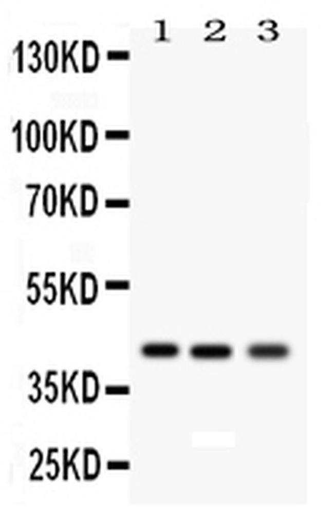 RAGE Antibody in Western Blot (WB)