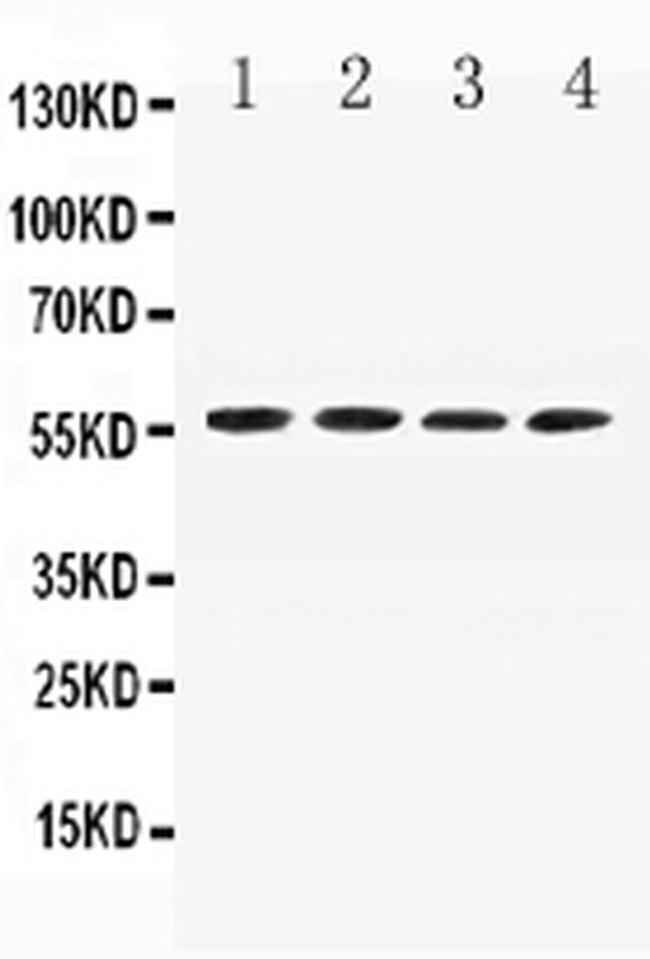 Angiotensinogen Antibody in Western Blot (WB)