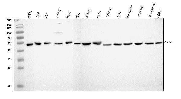 AGTR1 Antibody in Western Blot (WB)