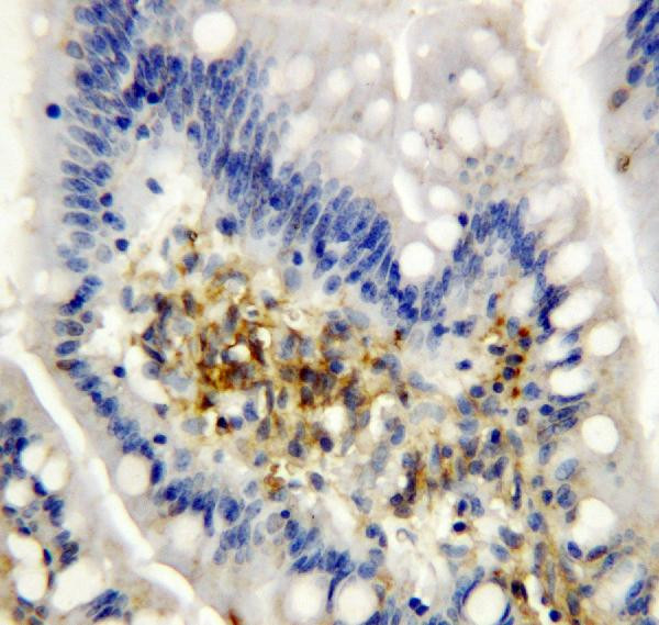 AIMP2 Antibody in Immunohistochemistry (Paraffin) (IHC (P))