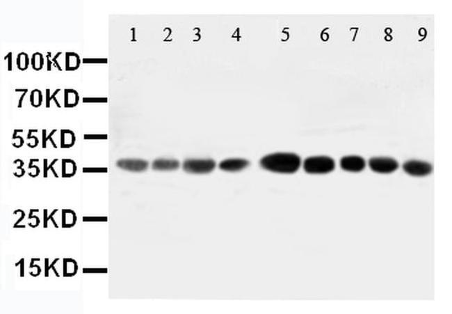 AIMP2 Antibody in Western Blot (WB)