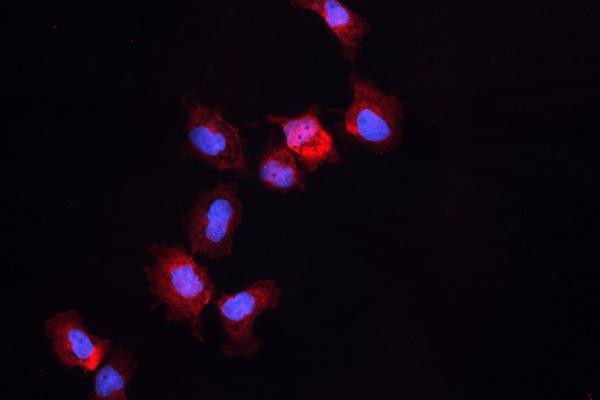 ALDH1A3 Antibody in Immunocytochemistry (ICC/IF)