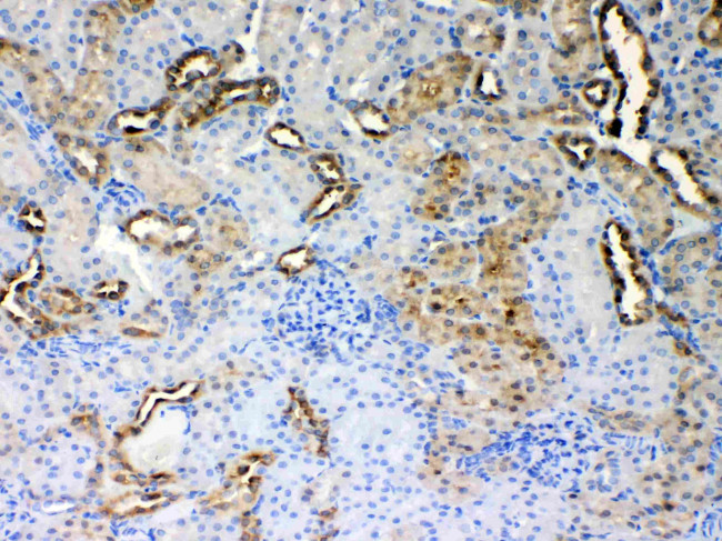 ALDH1A3 Antibody in Immunohistochemistry (Paraffin) (IHC (P))