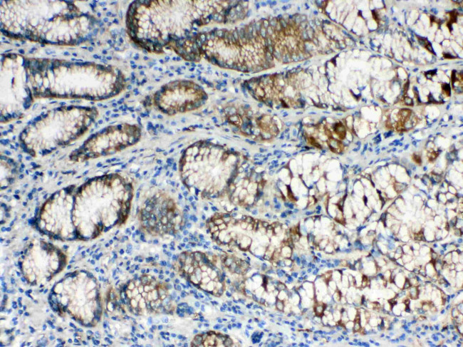 ALDH1A3 Antibody in Immunohistochemistry (Paraffin) (IHC (P))