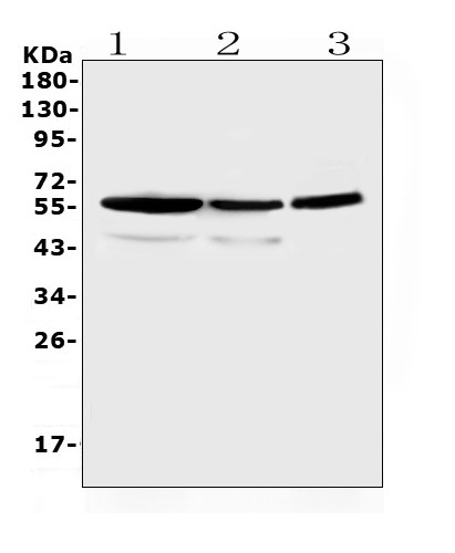 ALDH1A3 Antibody in Western Blot (WB)