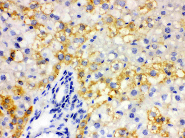 ALDH2 Antibody in Immunohistochemistry (Paraffin) (IHC (P))