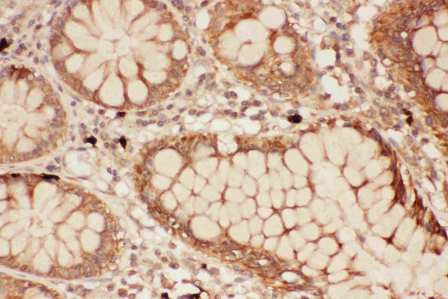 ALOX15 Antibody in Immunohistochemistry (Paraffin) (IHC (P))