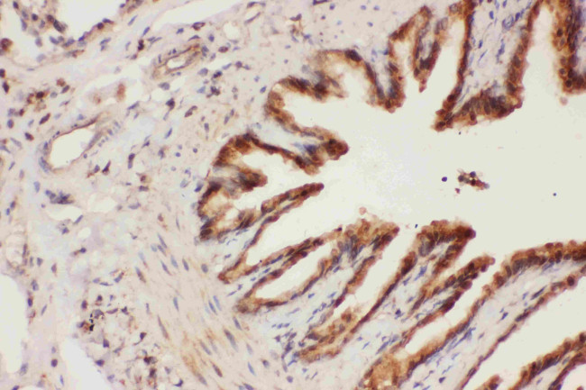 ALOX15 Antibody in Immunohistochemistry (Paraffin) (IHC (P))