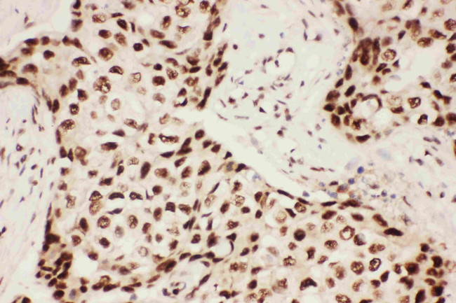 ALOX5 Antibody in Immunohistochemistry (Paraffin) (IHC (P))