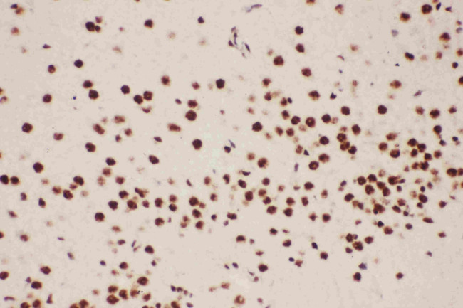 ALOX5 Antibody in Immunohistochemistry (Paraffin) (IHC (P))