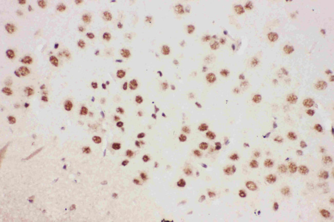 ALOX5 Antibody in Immunohistochemistry (Paraffin) (IHC (P))