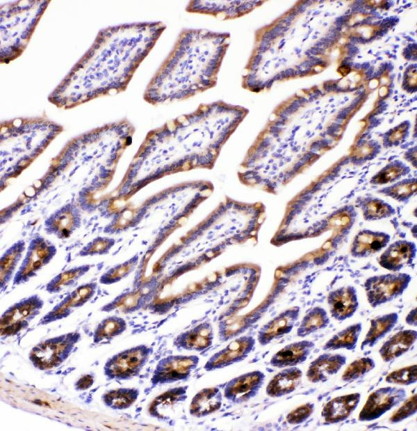 AMFR Antibody in Immunohistochemistry (Paraffin) (IHC (P))