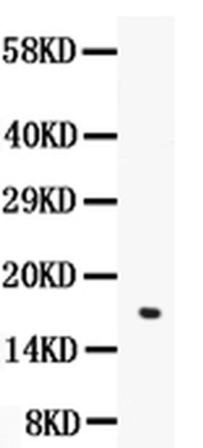 Angiogenin Antibody in Western Blot (WB)