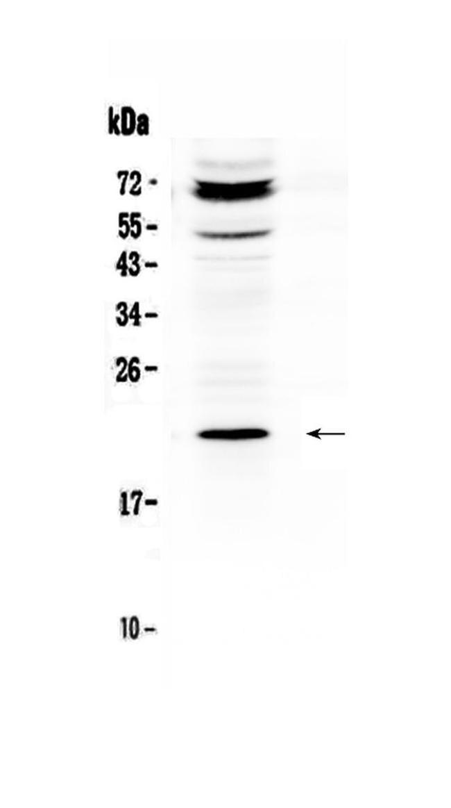 Betatrophin Antibody in Western Blot (WB)