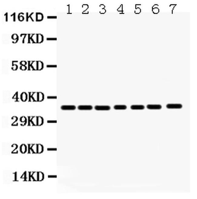 Annexin A3 Antibody in Western Blot (WB)