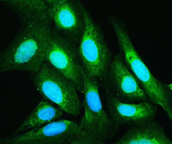 Annexin V Antibody in Immunocytochemistry (ICC/IF)