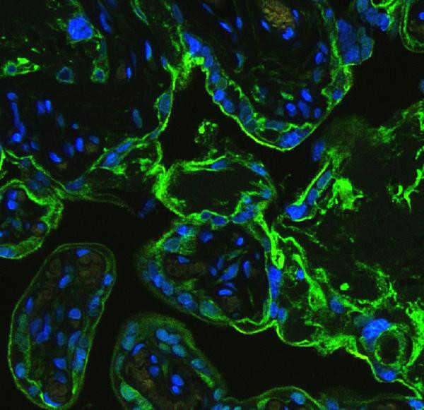 Annexin V Antibody in Immunohistochemistry (IHC)