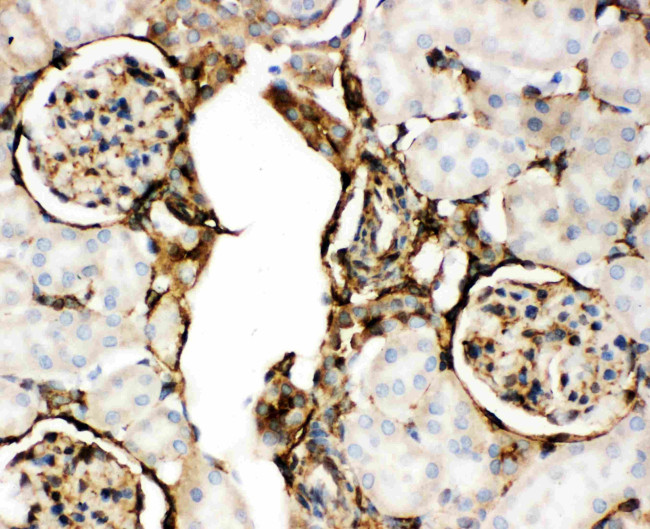 Annexin V Antibody in Immunohistochemistry (Paraffin) (IHC (P))