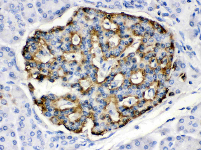 APOBEC3G Antibody in Immunohistochemistry (Paraffin) (IHC (P))