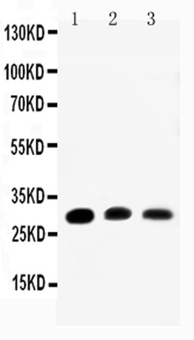 Aquaporin 1 Antibody in Western Blot (WB)