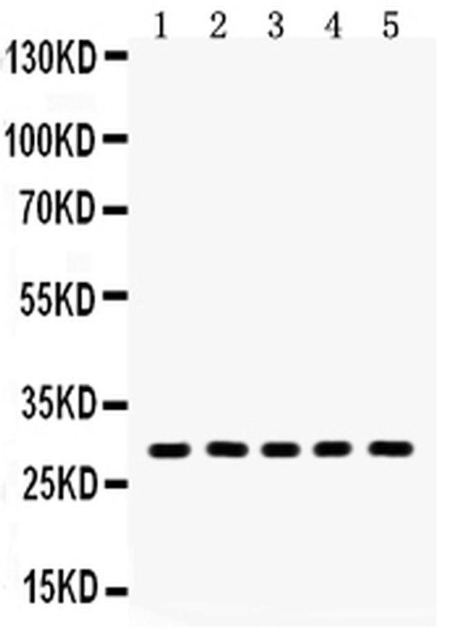 Aquaporin 1 Antibody in Western Blot (WB)