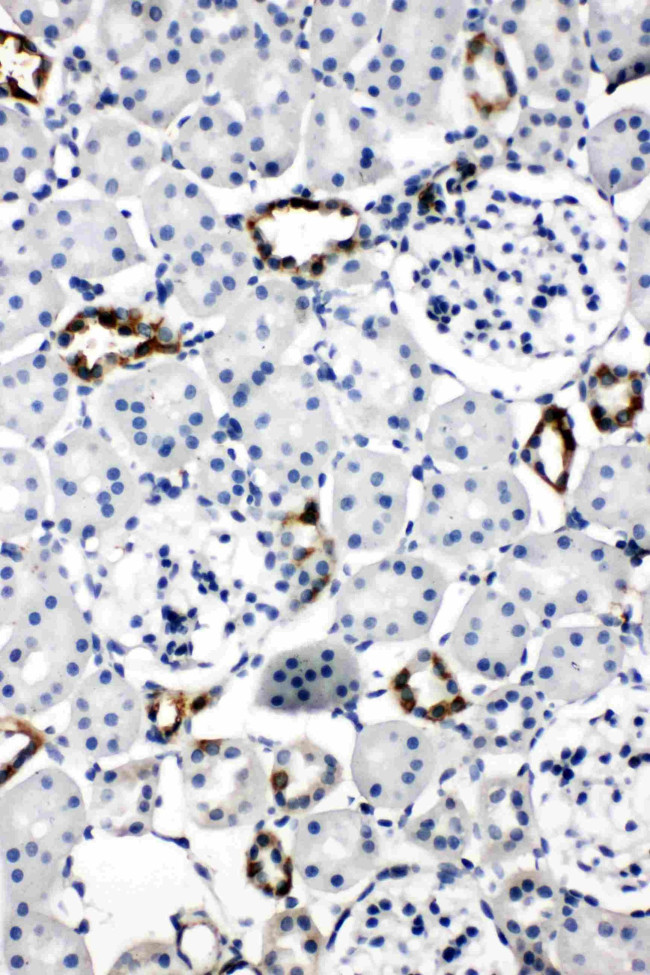 Aquaporin 2 Antibody in Immunohistochemistry (Paraffin) (IHC (P))