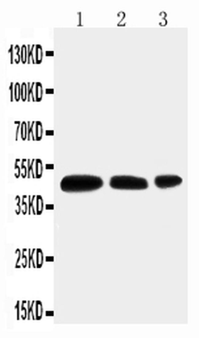 Aquaporin 2 Antibody in Western Blot (WB)