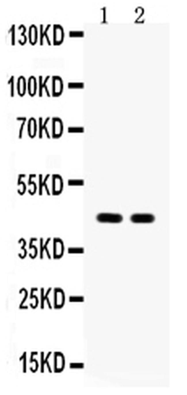 Aquaporin 4 Antibody in Western Blot (WB)