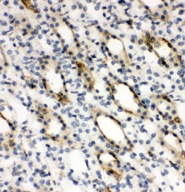 Arginase 2 Antibody in Immunohistochemistry (Paraffin) (IHC (P))