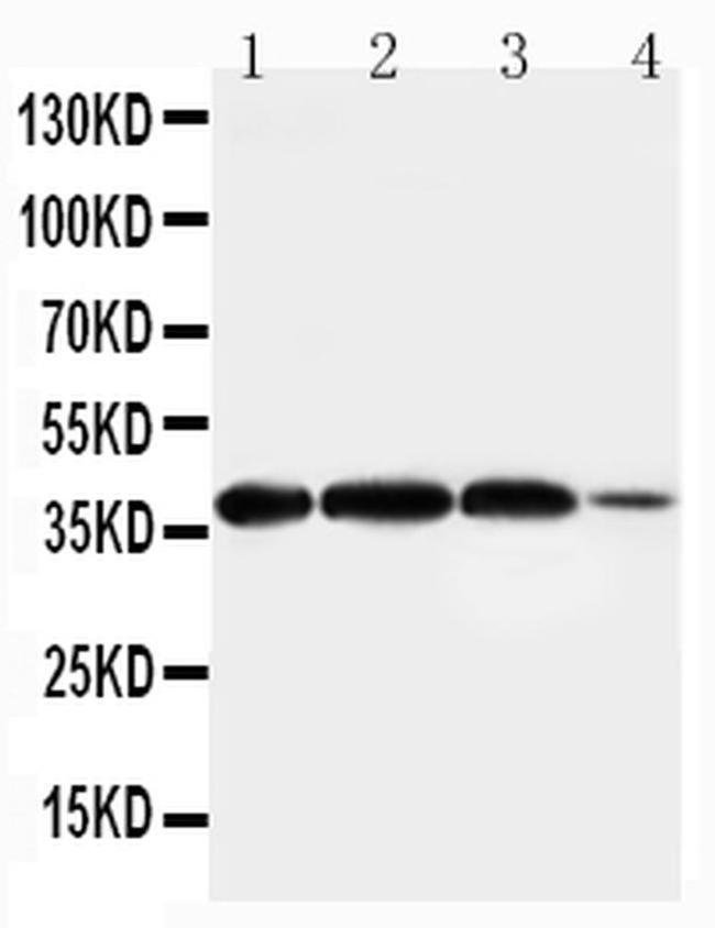 Arginase 2 Antibody in Western Blot (WB)