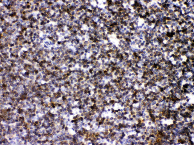 ARHGEF1 Antibody in Immunohistochemistry (Paraffin) (IHC (P))