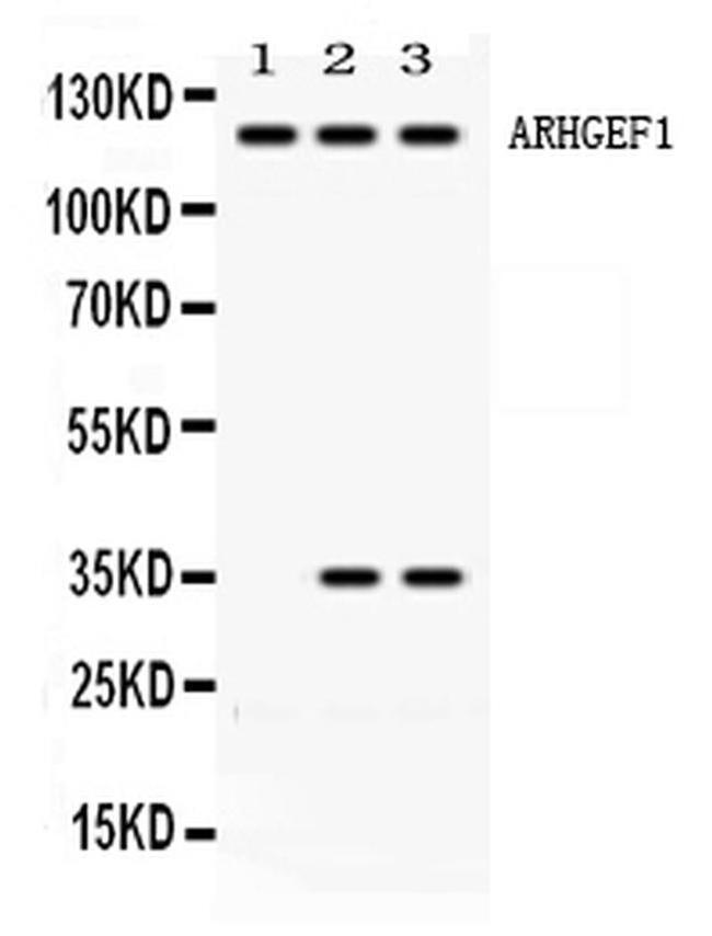 ARHGEF1 Antibody in Western Blot (WB)