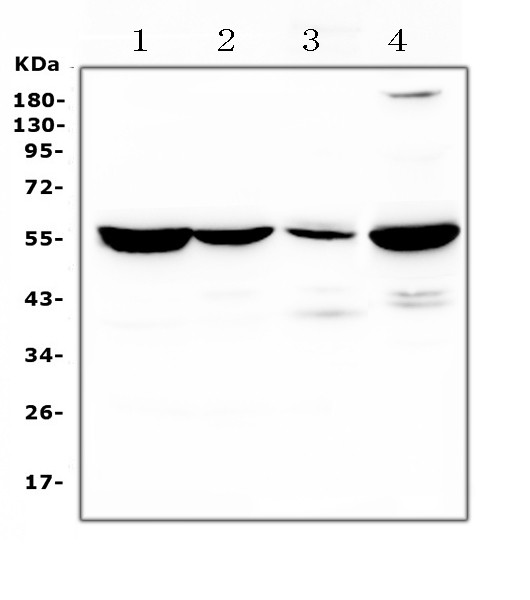 ASL Antibody in Western Blot (WB)