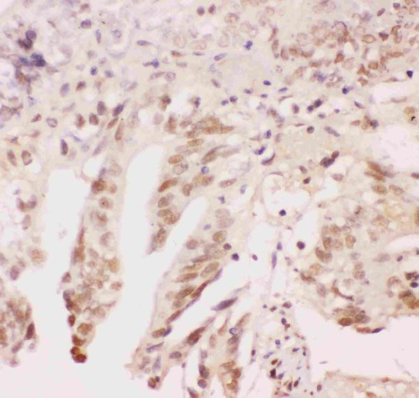 ATF1 Antibody in Immunohistochemistry (Paraffin) (IHC (P))