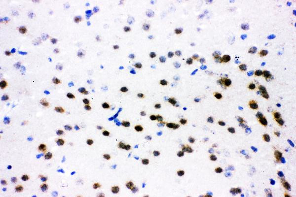 ATF2 Antibody in Immunohistochemistry (Frozen) (IHC (F))