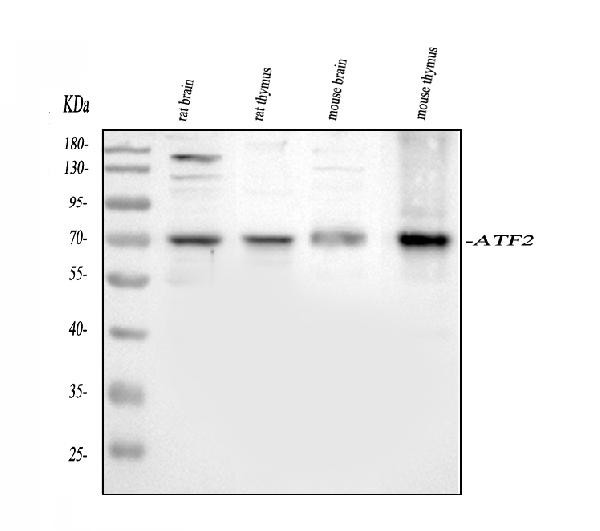 ATF2 Antibody in Western Blot (WB)