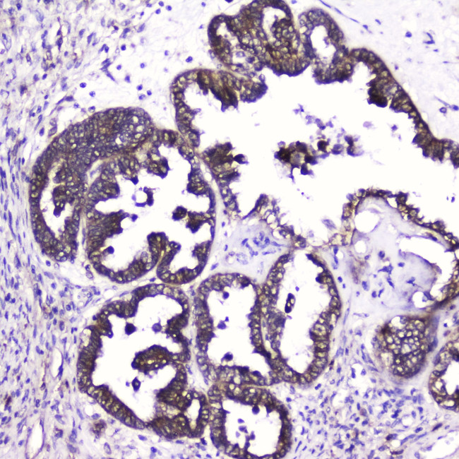 ATF4 Antibody in Immunohistochemistry (Paraffin) (IHC (P))