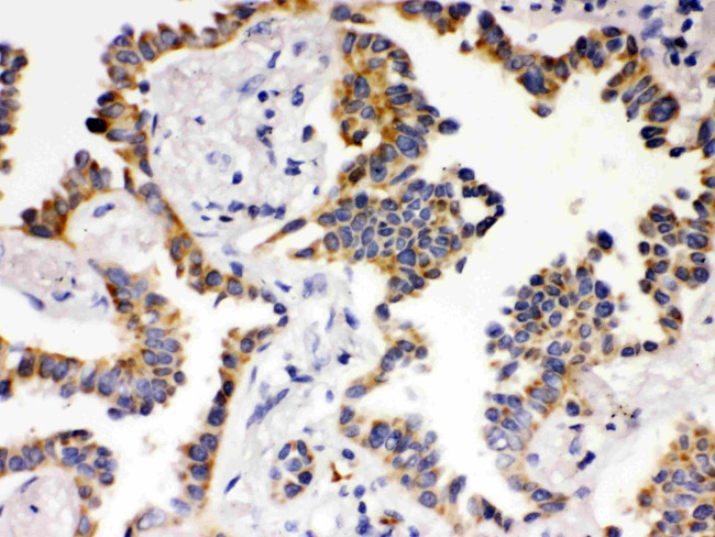 ATG14 Antibody in Immunohistochemistry (Paraffin) (IHC (P))