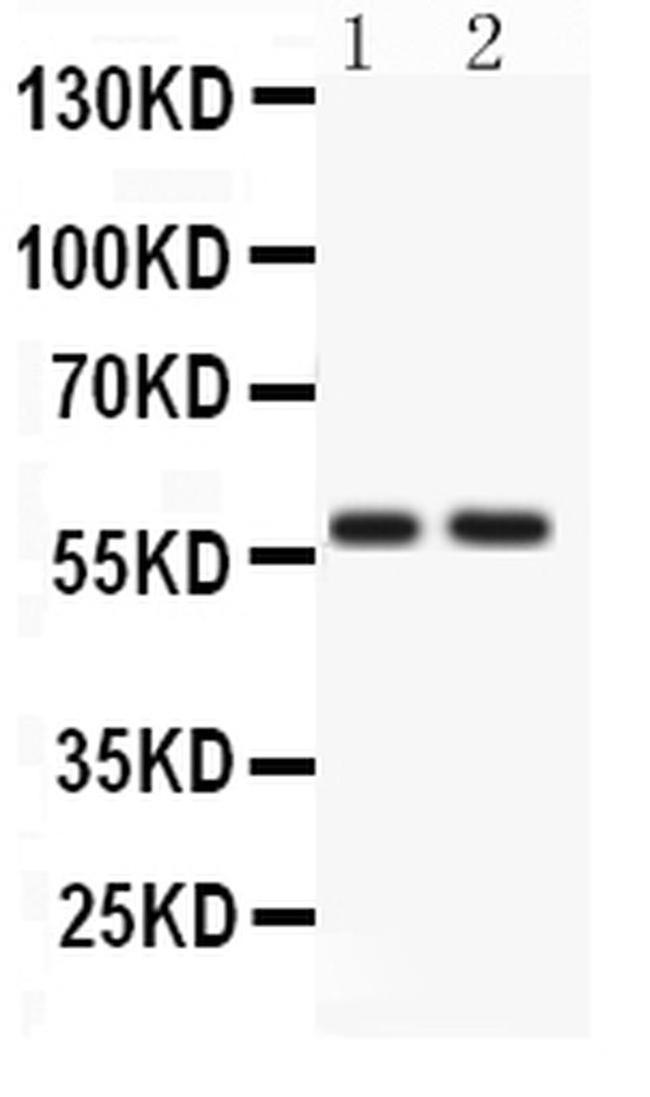 ATG14 Antibody in Western Blot (WB)